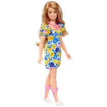 Barbie Fashionista com síndrome de Down - Mattel
