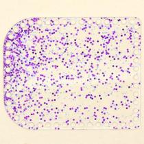 Base Acrílica Retangular Decorada para Crochê - 22x18cm