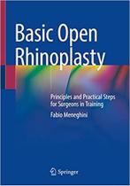 Basic open rhinoplasty - Springer Nature (import) Basic open rhinoplasty - Springer Nature (import)