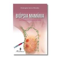 Biopsia Mamaria: Guia Pratico para Profissionais da Saude Biopsia Mamaria: Guia Pratico para Profissionais da Saude