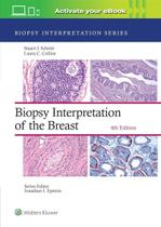 Biopsy interpretation of the breast
