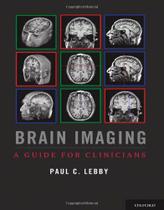 Brain imaging - OXFORD UNIVERSITY PRESS