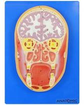 Cabeça Humana Em Corte Frontal E Cérebro - Anatomic