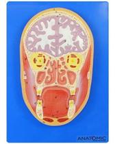 Cabeça Humana Em Corte Frontal E Cérebro Cabeça Humana Em Corte Frontal E Cérebro