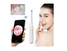 Câmera Dentista e Veterinario Wifi Wireless Hd Intra Oral Dental Odontologia Pet