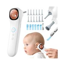 Câmera Digital De Ouvido 1080p HD Com Tela IPS, Ferramenta Inteligente Para Cuidados Com Ouvido, Câmera Digital De Ouvido 1080p HD Com Tela IPS, Ferramenta Inteligente Para Cuidados Com Ouvido,