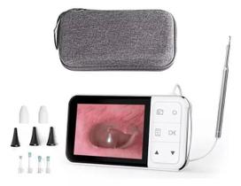Câmera Hd Endo Oto Digital Tela Lcd Ouvido Nariz