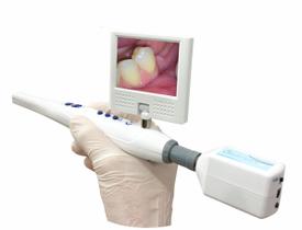 CÂMERA INTRAORAL BIOTRON Com Monitor de 2,5 e bateria