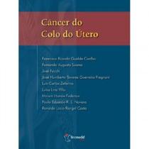Cancer do colo do utero - NOVO CONCEITO Cancer do colo do utero - NOVO CONCEITO