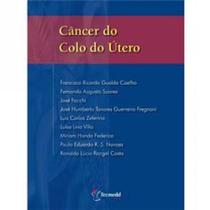 Cancer do colo do utero - TECMEDD Cancer do colo do utero - TECMEDD
