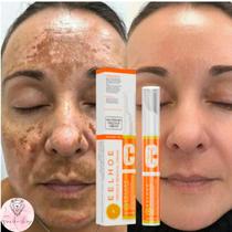 Caneta Creme Vitamina C Removedora De Manchas Melasma Sarda - EELHOE