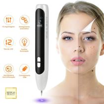 Caneta de Plasma Especial MBeauty M22 - 12 Níveis