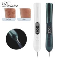 Caneta de Plasma Portátil para Remoção de Manchas - Ajustável, USB Recarregável (Verde Escuro)