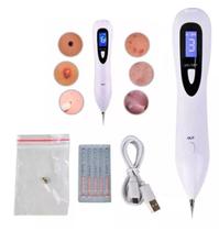 Caneta Despigmentador Jato De Plasma 6 Intensidades Display Digital Caneta Despigmentador Jato De Plasma 6 Intensidades Display Digital