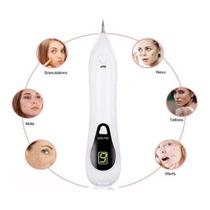 Caneta Despigmentador Jato De Plasma Com 5 Agulhas