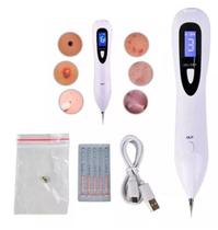 Caneta Despigmentadora Jato De Plasma 6 Intensidades Display Digital Caneta Despigmentadora Jato De Plasma 6 Intensidades Display Digital