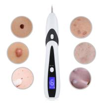 Caneta jato de plasma medical beauty + luz laser azul + brindes Caneta jato de plasma medical beauty + luz laser azul + brindes