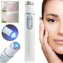 Caneta Laser Portátil para Remoção de Manchas, Rugas, Acne e Verrugas