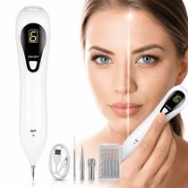Caneta Remove Manchas Eletrica Estetica Portatil Tipo Plasma Com Display Digital Recarregavel Jato D