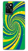 Capa Adesivo Skin360 Verso Para Infinix Note 10 Pro (2021)