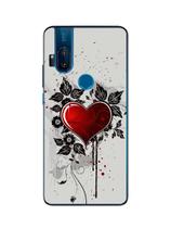 Capa Adesivo Skin364 Verso Para Motorola One Hyper