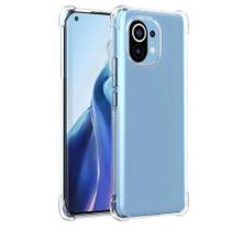 Capa Anti Impacto Compatível com Xiaomi 11 Lite 5G New Version - Coronitas