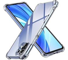 Capa Case Xiaomi Mi 11 Lite 5g Ne + Pelicula Vidro 3d 5d 9d