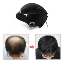 Capacete Laser Diodo Calvicie Tratamento Cabelo AntiquedaATS Capacete Laser Diodo Calvicie Tratamento Cabelo AntiquedaATS