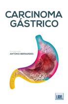 Carcinoma Gástrico Carcinoma Gástrico