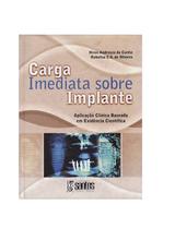 Carga Imediata Sobre Implantes: Aplicacao Clinica Baseada em Evidencia. - SANTOS