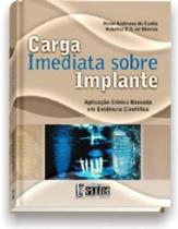 Carga imediata sobre implantes: aplicacao clinica baseada em evidencia ...
