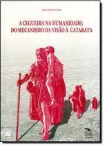 Cegueira na Humanidade, A: Do Mecanismo da Visão À Catarata Cegueira na Humanidade, A: Do Mecanismo da Visão À Catarata