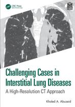 Challenging Cases In Interstitial Lung Diseases