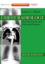 Chest Radiology - Plain Film Patterns And Differential Diagnoses - ELSEVIER (IMPORTADOS) Chest Radiology - Plain Film Patterns And Differential Diagnoses - ELSEVIER (IMPORTADOS)