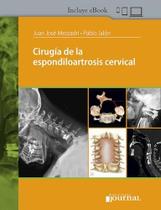 Cirugia de la espondiloartrosis cervical - Ediciones Journal Sa Cirugia de la espondiloartrosis cervical - Ediciones Journal Sa