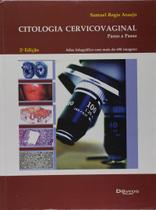 Citologia cervicovaginal passoa passo