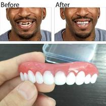 Clareamento Dental Instantâneo: Durável, Resistente e Fácil de Usar
