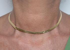 Colar Liso Detalhado Banhado em Ouro 18K Colar Liso Detalhado Banhado em Ouro 18K
