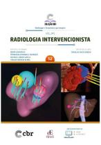 Coleção Cbr Volume 12: Radiologia Intervencionista