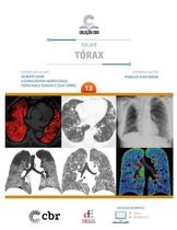 Coleção CBR Volume 13: Tórax