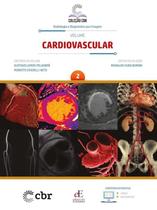 Colecao Cbr Volume 2: Cardiovascular Colecao Cbr Volume 2: Cardiovascular