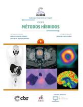 Coleção CBR Volume 6: Métodos Híbridos Coleção CBR Volume 6: Métodos Híbridos