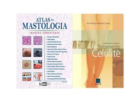 Combo atlas da mastologia + tratamento da celulite