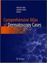 Comprehensive atlas of dermatoscopy cases