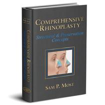 Comprehensive rhinoplasty - Quality Medical Publishing Comprehensive rhinoplasty - Quality Medical Publishing