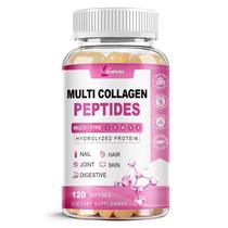 Comprimidos de peptídeos de colágeno ZHPHK hidrolisados tipo I II III V X