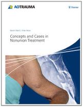 Concepts and cases in. nonunion treatment. - THIEME MEDICAL PUBLISHERS/MAPLE PRESS