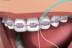 Condutor de fio dental PASSAFIO c/ 60un - Dreen Professional