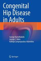 Congenital hip disease in adults - SPRINGER (IMPORT) Congenital hip disease in adults - SPRINGER (IMPORT)