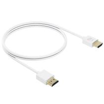 Conjunto de Acessórios Xiaomi 4K - Cabo HDMI e Cabo de Vídeo com Conector Banhado a Ouro 24K (1,5m)